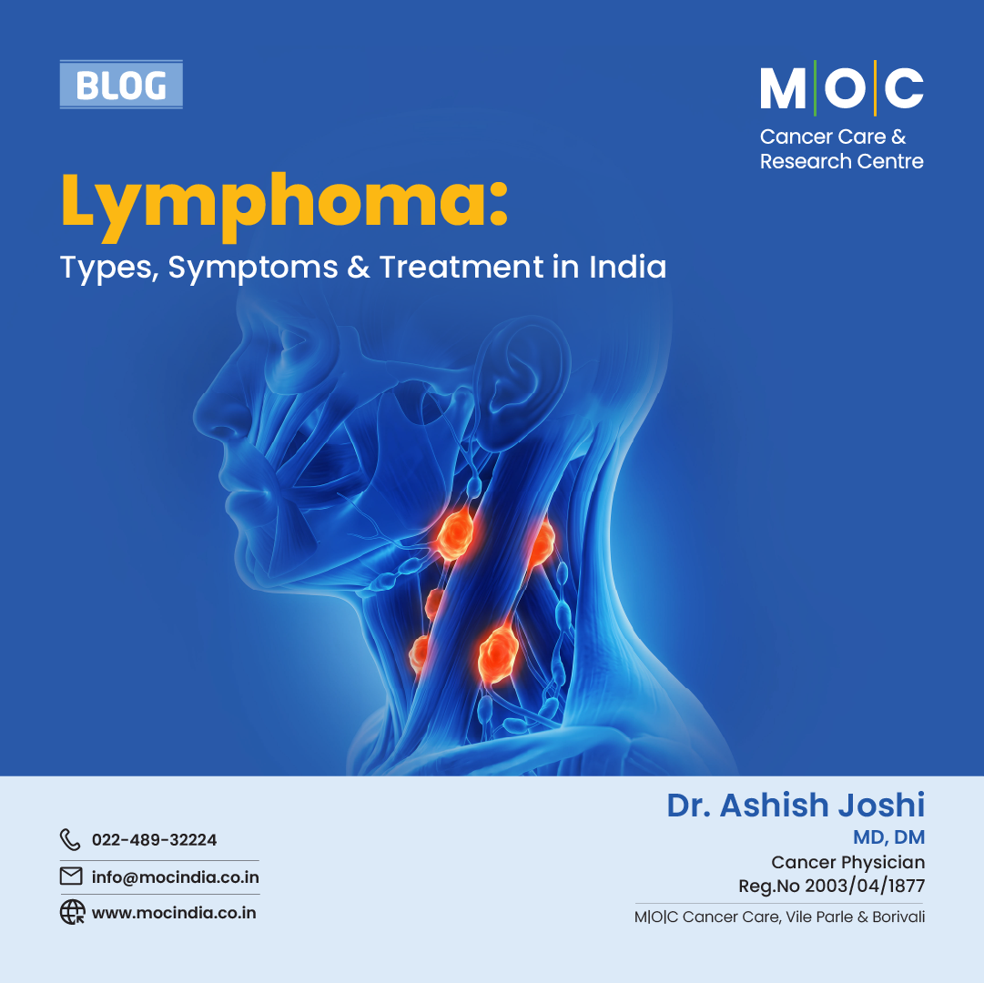 Lymphoma: Types, Symptoms & Treatment in India